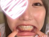 【個人撮影】激カワ美少女音大生の矯正歯観察＆鉛筆かじり　ゆい【Y-174】