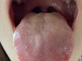 真面目そうな学生さんの舌苔は黄色味 アヤナ KITR00291