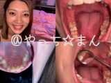 【個人撮影】実はエッチな近所のお姉さんの歯観察　香苗レノン【Y-221】