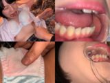 歯姫 41人目 [FBOM-00099]